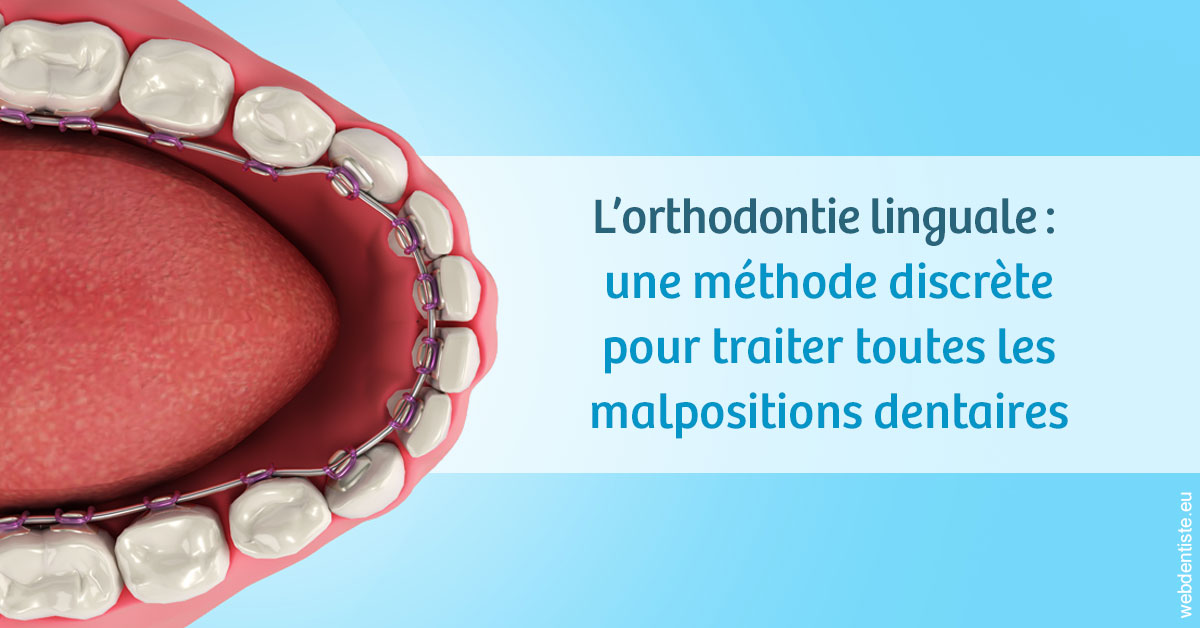 https://dr-gregori-laetitia.chirurgiens-dentistes.fr/L'orthodontie linguale 1