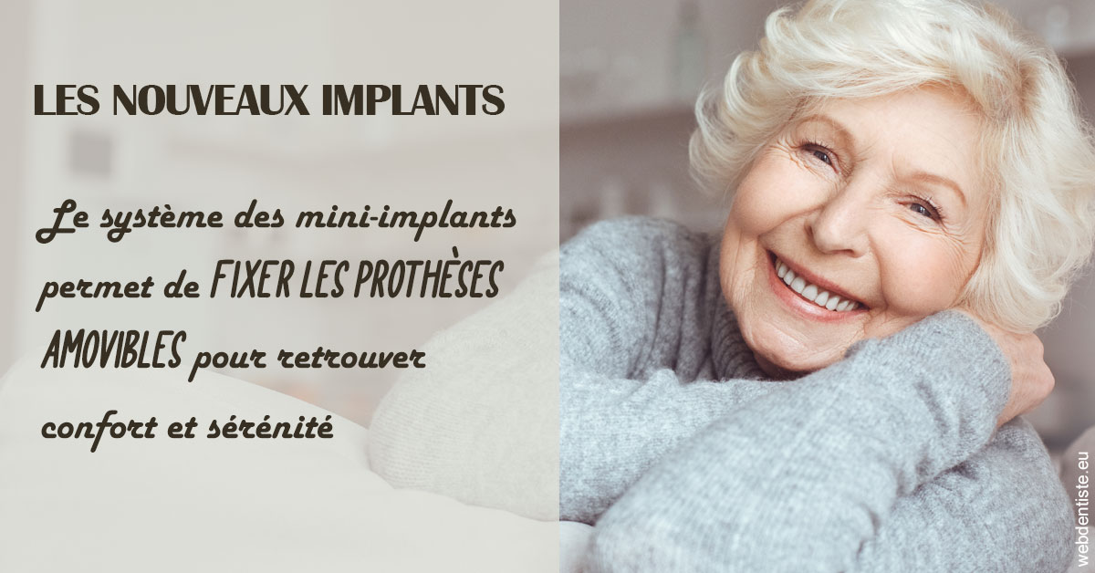 https://dr-gregori-laetitia.chirurgiens-dentistes.fr/Les nouveaux implants 1