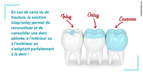 https://dr-gregori-laetitia.chirurgiens-dentistes.fr/L'INLAY ou l'ONLAY