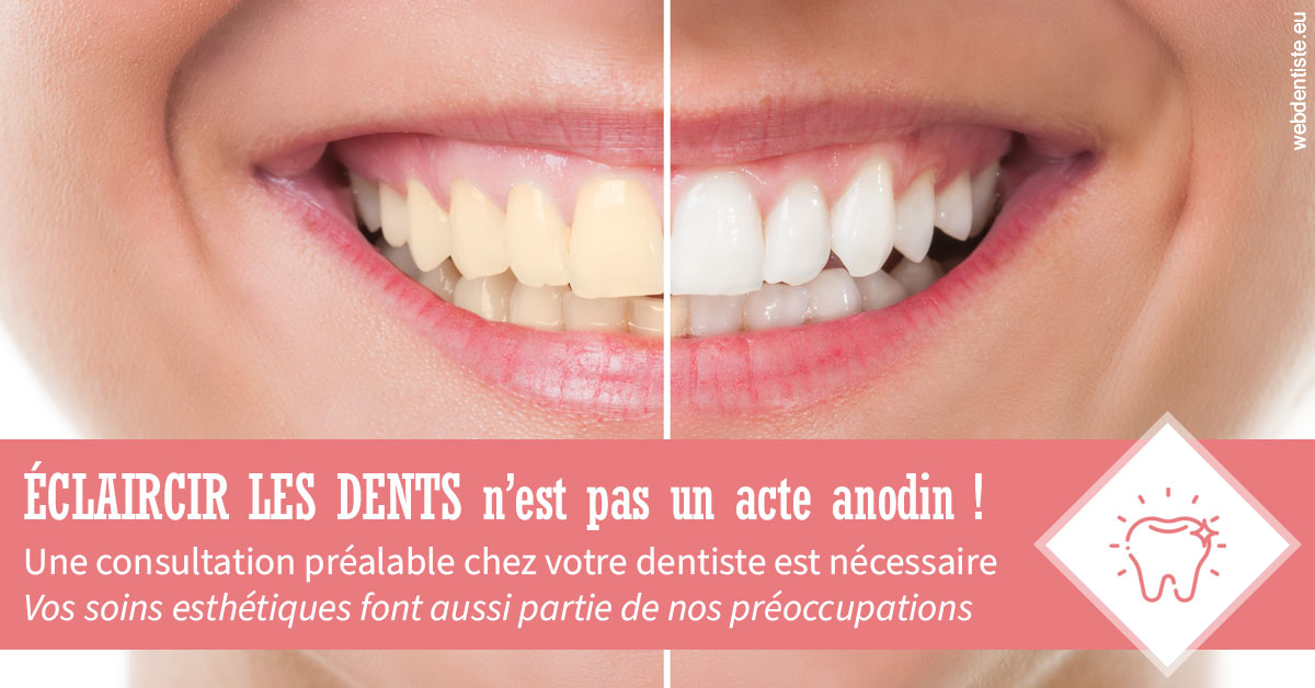 https://dr-gregori-laetitia.chirurgiens-dentistes.fr/Eclaircir les dents 1