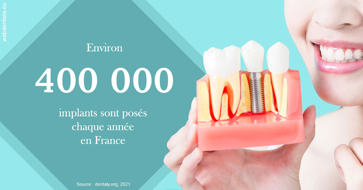 https://dr-gregori-laetitia.chirurgiens-dentistes.fr/Pose d'implants en France 2